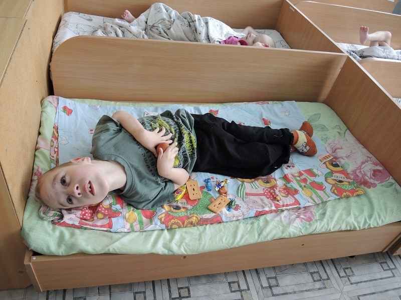 ребёнок  с особенностями  развития  лежит в   кровати